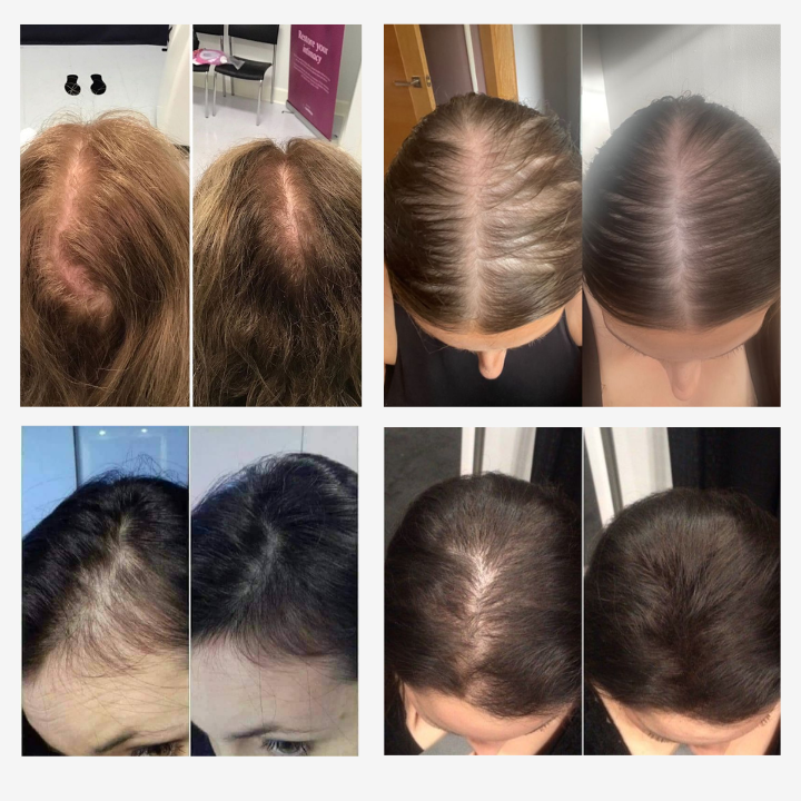VÉRA™ Serum - Obudź Mieszki, Odzyskaj Gęstość