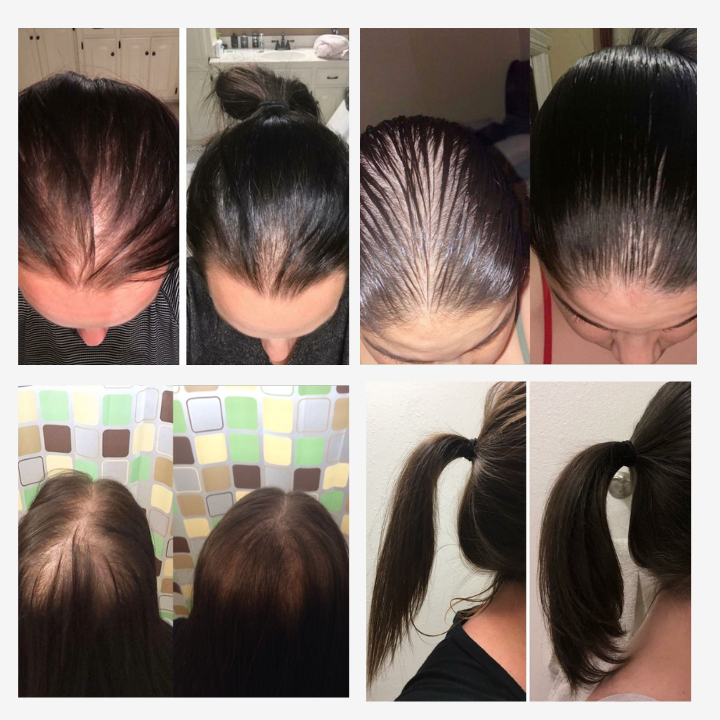 VÉRA™ Serum - Obudź Mieszki, Odzyskaj Gęstość
