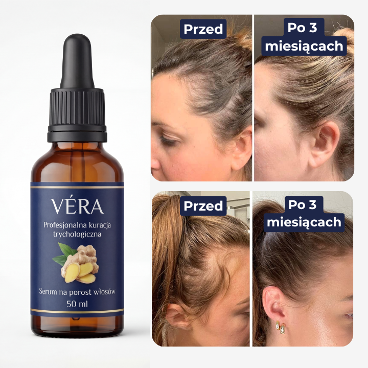 VÉRA™ Serum - Zatrzymaj Wypadanie i Odbuduj Gęstość