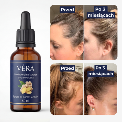 VÉRA™ Serum - Zatrzymaj Wypadanie i Odbuduj Gęstość